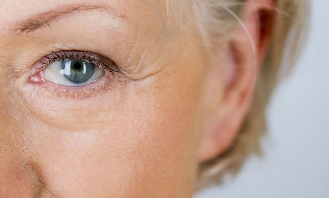What Is The Difference Between “Wet” And “Dry” Age-Related Macular Degeneration (AMD)?